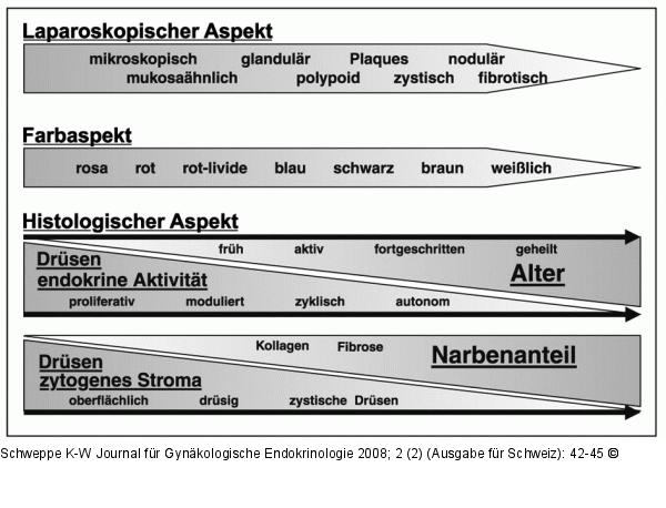 Peritonealendometriose