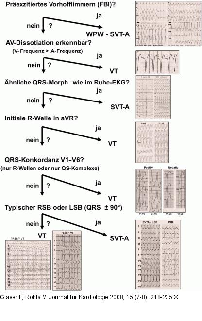 BQRST-Differentialdiagnostik