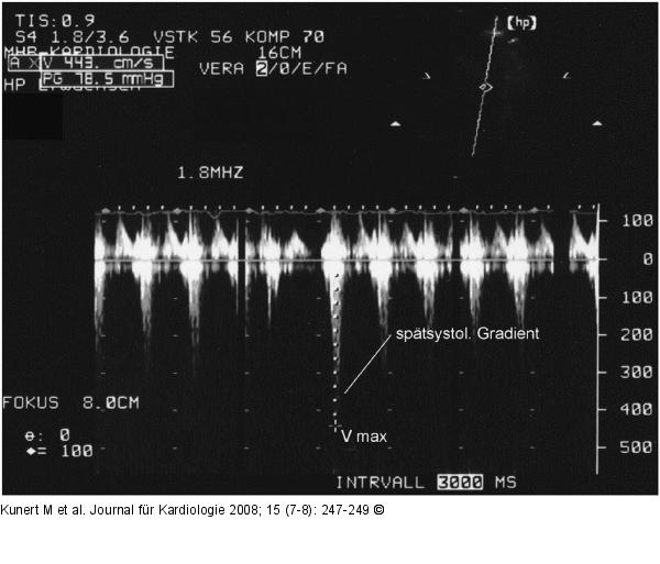 LVOT