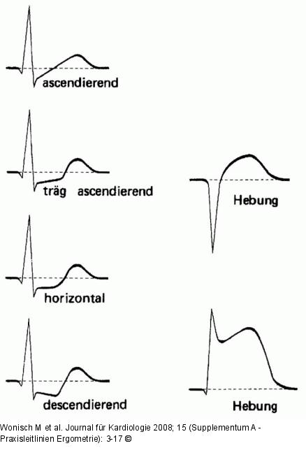 ST-Streckenvernderungen
