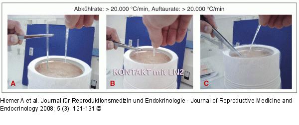 Vitrifikation