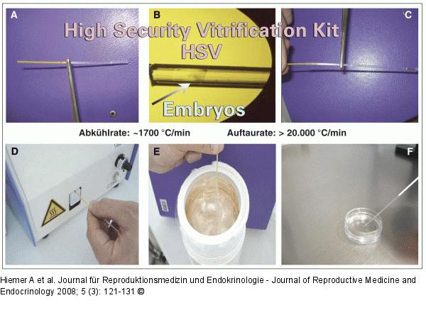 Aseptische Vitrifikation 
