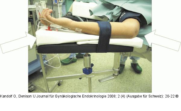 Unterpolsterung
