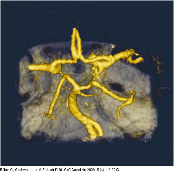Circulus arteriosus