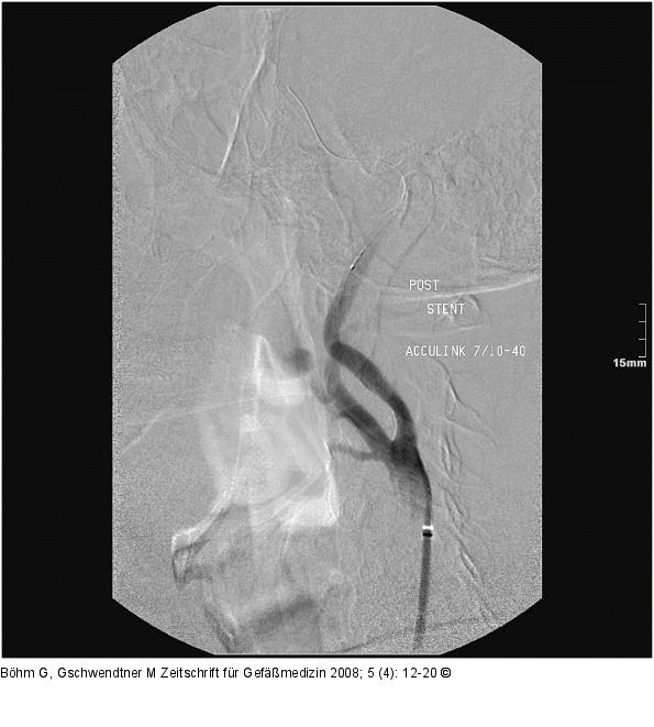 Angiographie