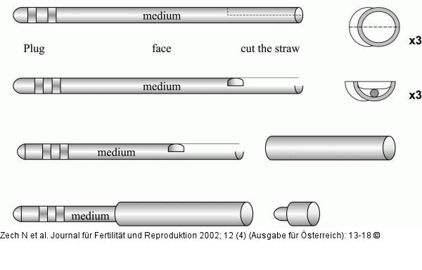 Kryokonservierung - Hemistraw-System