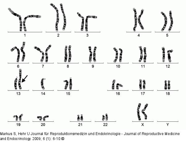 Female Karyotype