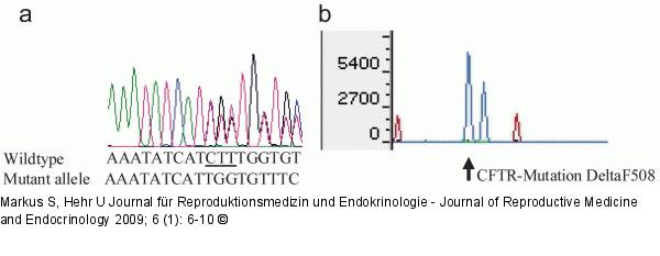 PCR