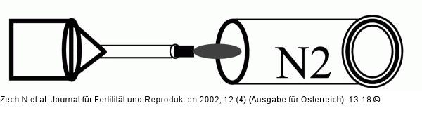 Hemistraw-System