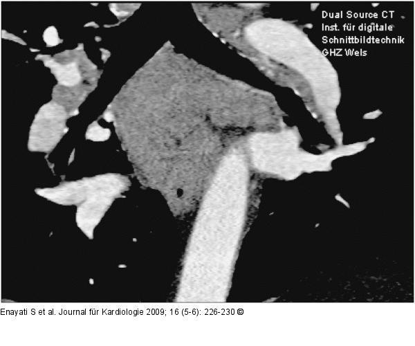 CT-Angiographie