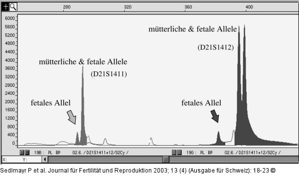 Fetale DNA - mtterliche DNA