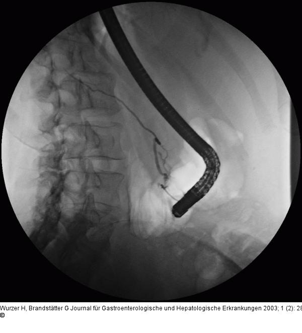 Ductus pancreaticus