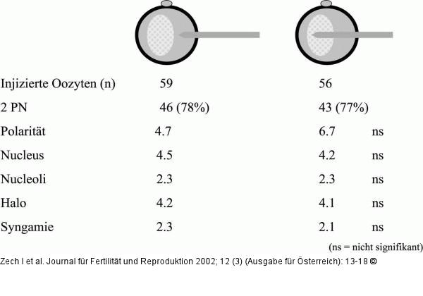 Zygotenentwicklung