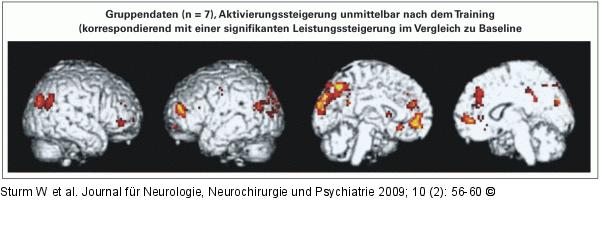 Aktivierungsmuster