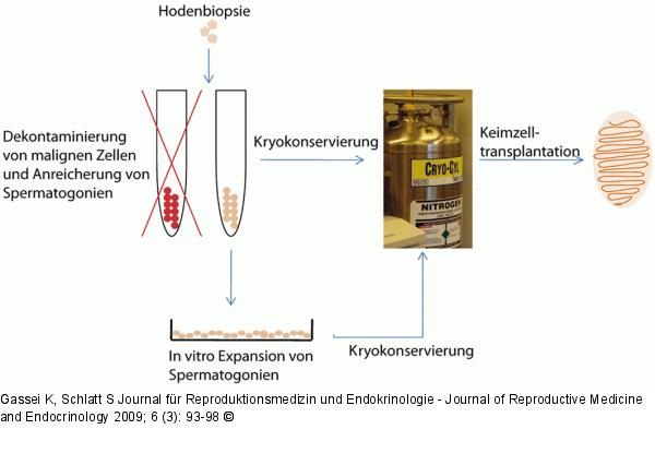 Keimzelltransplantation