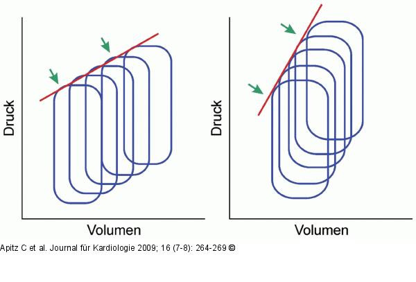 Druck-Volumen-Kurven