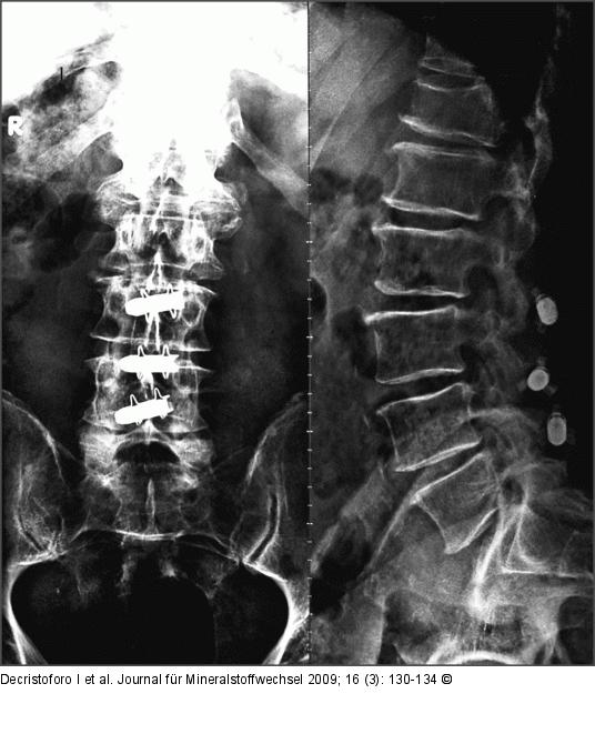 Wirbelsulenchirurgie
