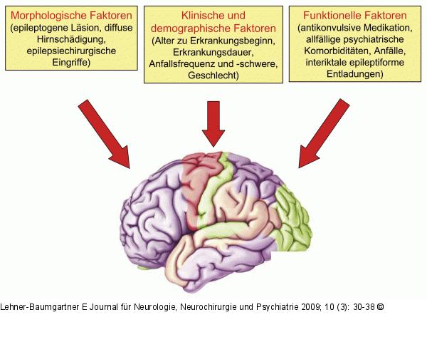 Epilepsie