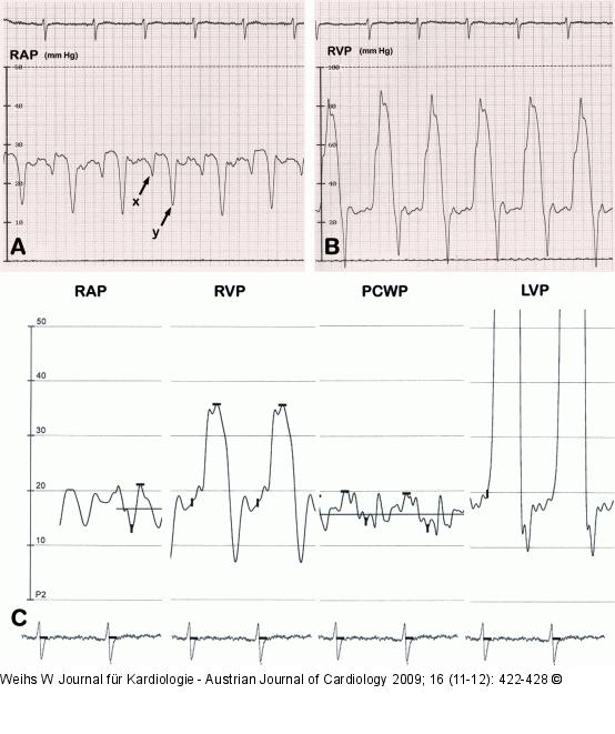 PC- Invasive Hmodynamik