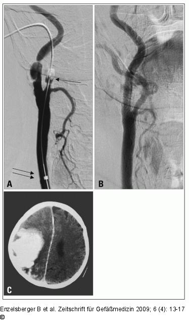 Angiographie - MRT