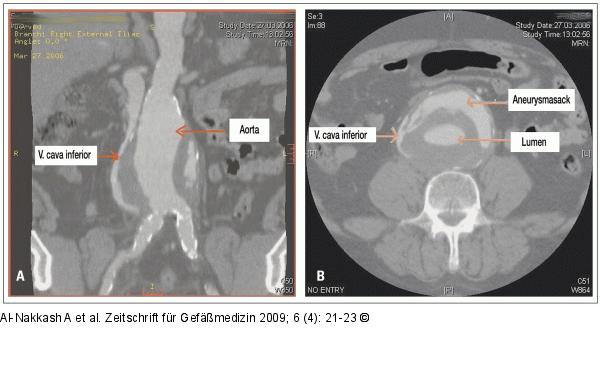 CT-Angiographie
