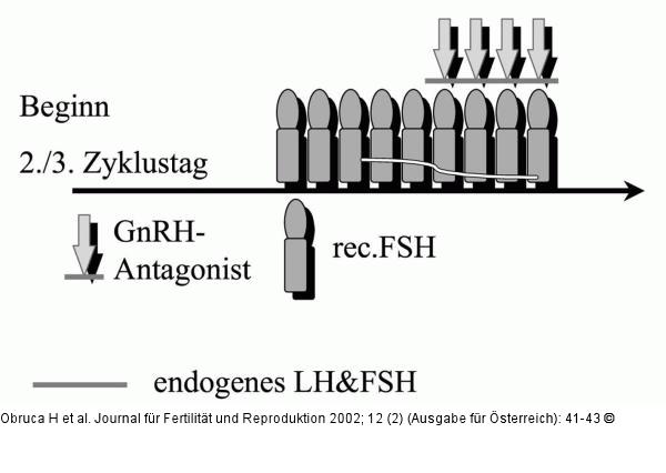 IVF-Protokoll