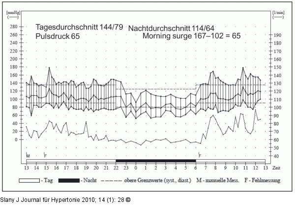 24-h-Blutdruckprofil