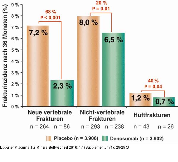 Denosumab - Hftfrakturrisiko