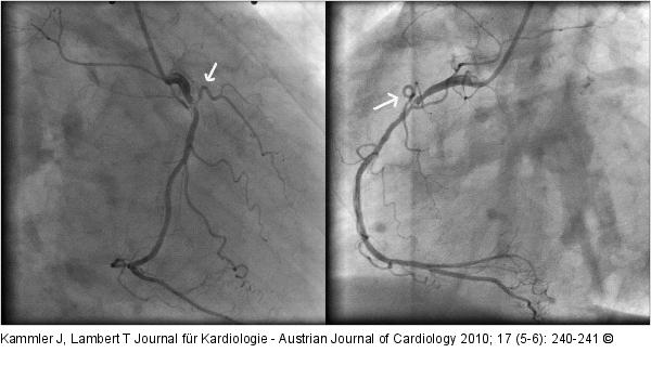 Angiographie