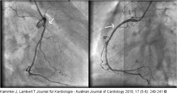 Angiographie