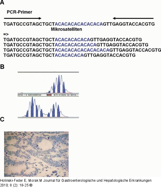Mikrosatellitenanalyse - Immunhistochemische Analyse