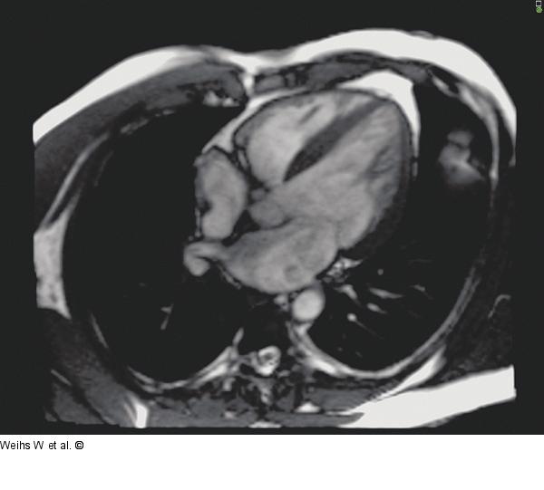 Cardiac MR