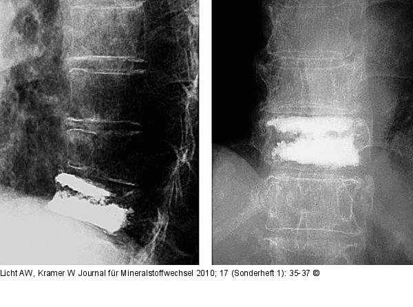 Postoperative Kontrolle