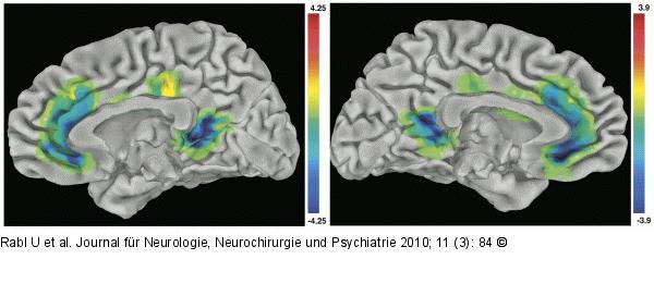 Serotonin-Wiederaufnahmegeschwindigkeit