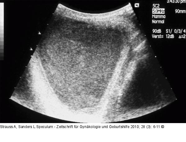Sonographie