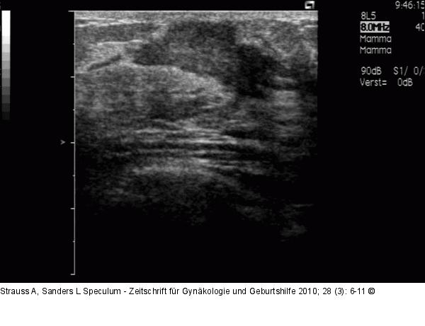 Sonographie
