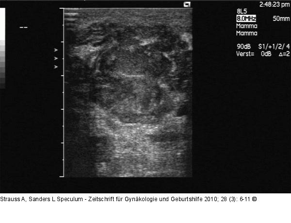 Sonographie