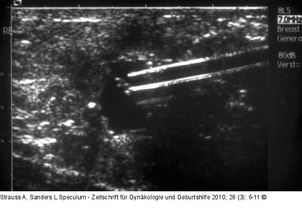 Sonographie