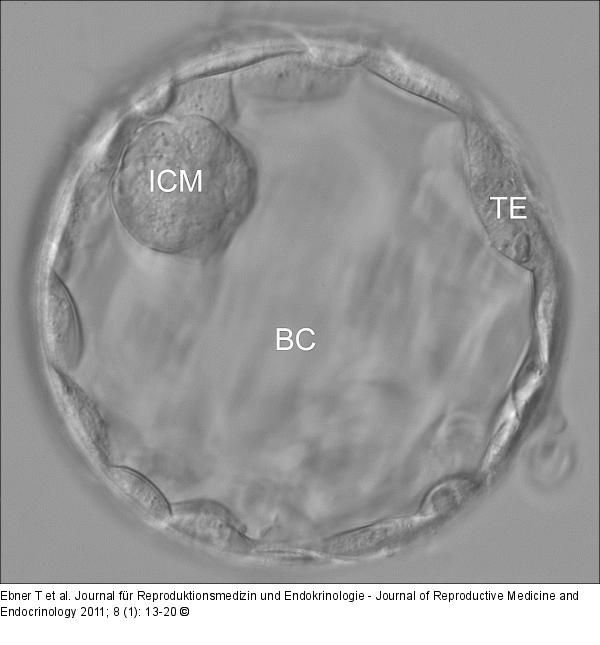 Blastocyst - Hatching