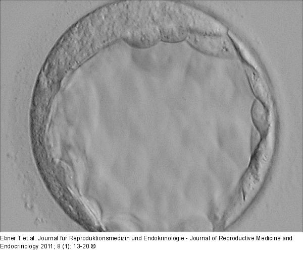Blastocyst