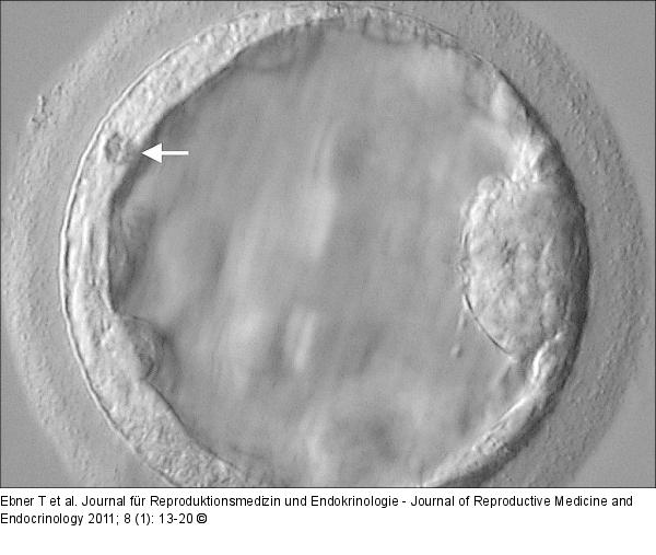 Blastocyst