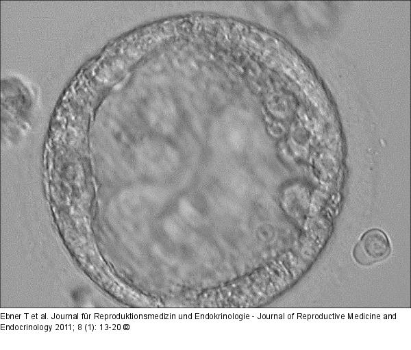 Trophoblast vesicle