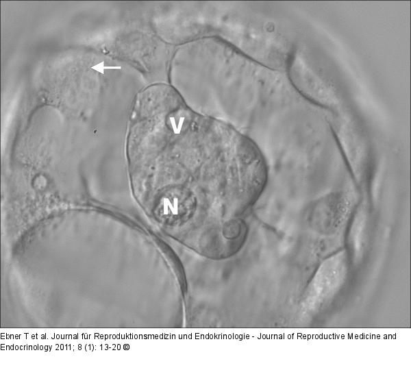 Inner cell mass
