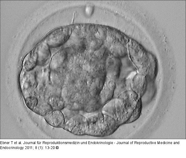 Blastocyst