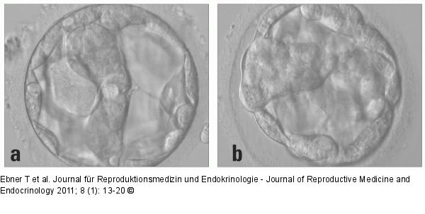Blastocyst