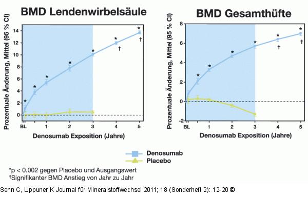 DXA - BMD