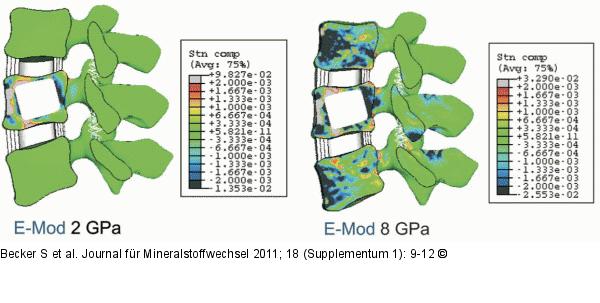 Cement stiffness 