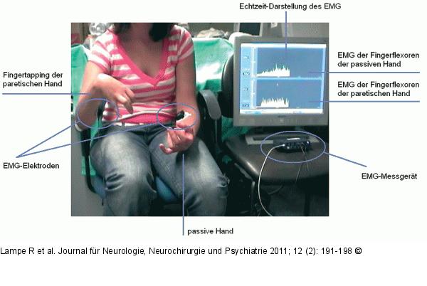EMG