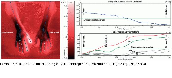 Klteexpositionstest
