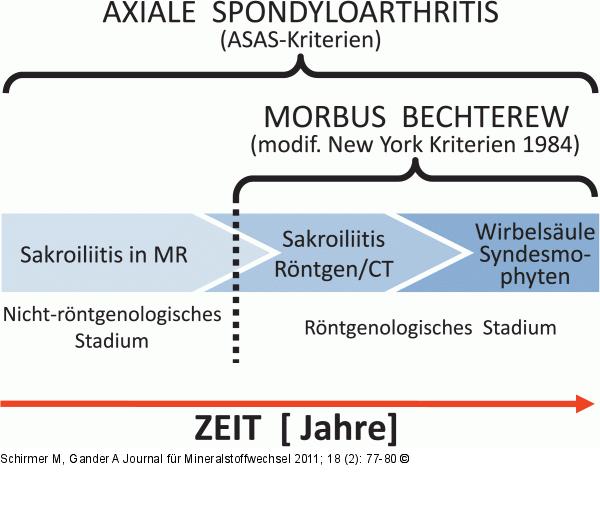 Stadieneinteilung Spondyloarthritis